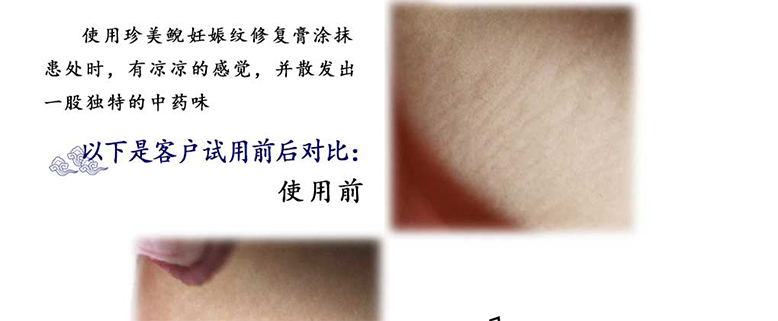 走魚(yú)妊娠紋修復套裝1_07.jpg